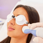 Laser Scar Resurfacing: A Modern Approach to Smoother, Healthier Skin